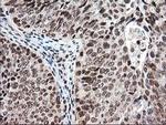 NUDT18 Antibody in Immunohistochemistry (Paraffin) (IHC (P))