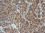 TRK fused gene Antibody in Immunohistochemistry (Paraffin) (IHC (P))