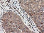TRK fused gene Antibody in Immunohistochemistry (Paraffin) (IHC (P))