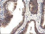 TRK fused gene Antibody in Immunohistochemistry (Paraffin) (IHC (P))