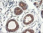 TRK fused gene Antibody in Immunohistochemistry (Paraffin) (IHC (P))