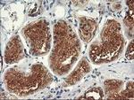 TRK fused gene Antibody in Immunohistochemistry (Paraffin) (IHC (P))