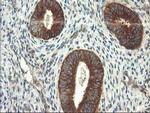 TRK fused gene Antibody in Immunohistochemistry (Paraffin) (IHC (P))