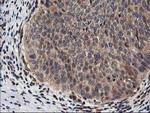 NUDT18 Antibody in Immunohistochemistry (Paraffin) (IHC (P))