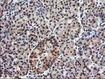 NUDT18 Antibody in Immunohistochemistry (Paraffin) (IHC (P))