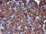 ERP72 Antibody in Immunohistochemistry (Paraffin) (IHC (P))