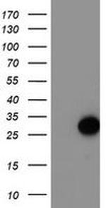 ARL11 Antibody in Western Blot (WB)
