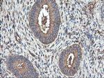 TUBAL3 Antibody in Immunohistochemistry (Paraffin) (IHC (P))