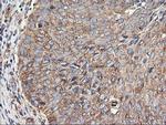 TUBAL3 Antibody in Immunohistochemistry (Paraffin) (IHC (P))
