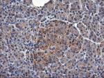 TUBAL3 Antibody in Immunohistochemistry (Paraffin) (IHC (P))