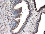 TUBAL3 Antibody in Immunohistochemistry (Paraffin) (IHC (P))
