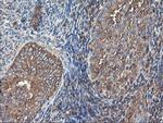 TUBAL3 Antibody in Immunohistochemistry (Paraffin) (IHC (P))