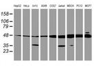 TUBAL3 Antibody in Western Blot (WB)