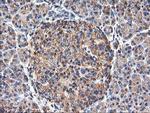 TUBAL3 Antibody in Immunohistochemistry (Paraffin) (IHC (P))