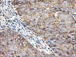 TUBAL3 Antibody in Immunohistochemistry (Paraffin) (IHC (P))
