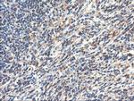 TUBAL3 Antibody in Immunohistochemistry (Paraffin) (IHC (P))