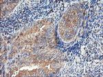 TUBAL3 Antibody in Immunohistochemistry (Paraffin) (IHC (P))