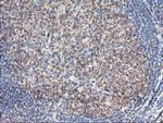 TUBAL3 Antibody in Immunohistochemistry (Paraffin) (IHC (P))