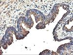 TUBAL3 Antibody in Immunohistochemistry (Paraffin) (IHC (P))