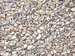 TUBAL3 Antibody in Immunohistochemistry (Paraffin) (IHC (P))