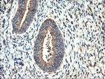 TUBAL3 Antibody in Immunohistochemistry (Paraffin) (IHC (P))