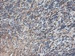 TUBAL3 Antibody in Immunohistochemistry (Paraffin) (IHC (P))