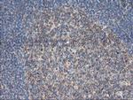 TUBAL3 Antibody in Immunohistochemistry (Paraffin) (IHC (P))