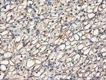 TUBAL3 Antibody in Immunohistochemistry (Paraffin) (IHC (P))