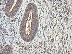 TUBAL3 Antibody in Immunohistochemistry (Paraffin) (IHC (P))