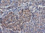 TUBAL3 Antibody in Immunohistochemistry (Paraffin) (IHC (P))