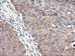 TUBAL3 Antibody in Immunohistochemistry (Paraffin) (IHC (P))
