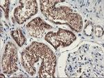 PDSS2 Antibody in Immunohistochemistry (Paraffin) (IHC (P))