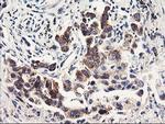 PDSS2 Antibody in Immunohistochemistry (Paraffin) (IHC (P))
