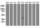 PDSS2 Antibody in Western Blot (WB)