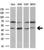 KVbeta1 (KCNAB1) Antibody in Western Blot (WB)