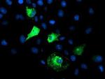 FBXO21 Antibody in Immunocytochemistry (ICC/IF)