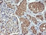 FBXO21 Antibody in Immunohistochemistry (Paraffin) (IHC (P))