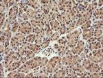 FBXO21 Antibody in Immunohistochemistry (Paraffin) (IHC (P))