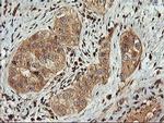 FBXO21 Antibody in Immunohistochemistry (Paraffin) (IHC (P))