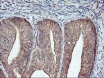 FBXO21 Antibody in Immunohistochemistry (Paraffin) (IHC (P))