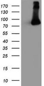 FBXO21 Antibody in Western Blot (WB)