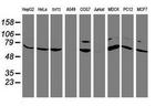FBXO21 Antibody in Western Blot (WB)