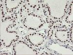 OBFC2B Antibody in Immunohistochemistry (Paraffin) (IHC (P))