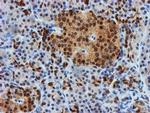 FBXO21 Antibody in Immunohistochemistry (Paraffin) (IHC (P))