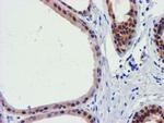 FBXO21 Antibody in Immunohistochemistry (Paraffin) (IHC (P))