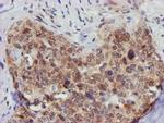 FBXO21 Antibody in Immunohistochemistry (Paraffin) (IHC (P))