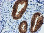 FBXO21 Antibody in Immunohistochemistry (Paraffin) (IHC (P))
