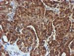 FBXO21 Antibody in Immunohistochemistry (Paraffin) (IHC (P))