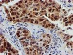 FBXO21 Antibody in Immunohistochemistry (Paraffin) (IHC (P))