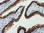FBXO21 Antibody in Immunohistochemistry (Paraffin) (IHC (P))